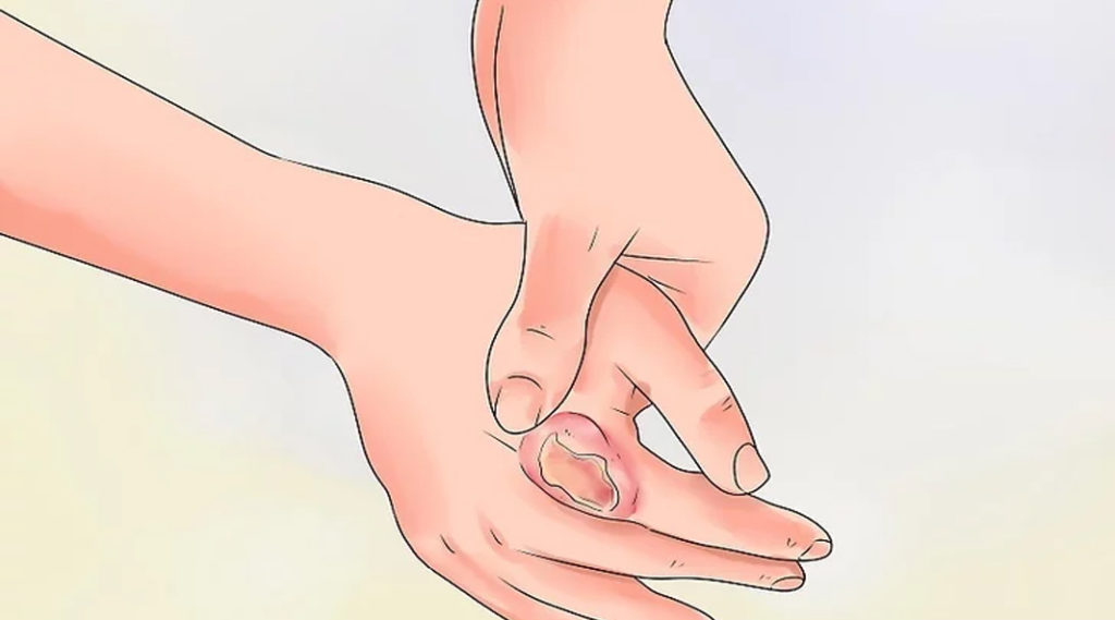 Sursă foto: https://www.wikihow.com