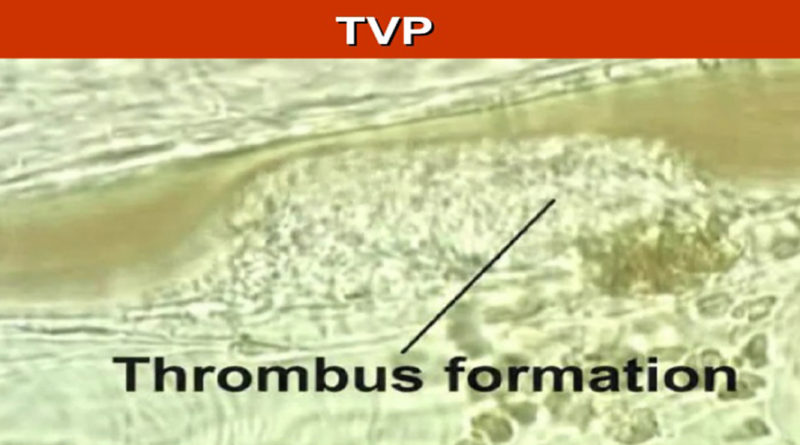 Cele mai întâlnite boli care nu prezintă simptome