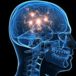 O nouă terapie pentru a reduce efectele degenerative ale bolii Parkinson