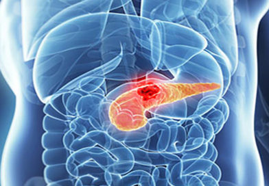 O nouă inovație pentru bolnavii de cancer