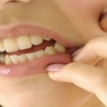 Simtome dentare pe care nu trebuie să le ignori