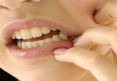 Simtome dentare pe care nu trebuie să le ignori