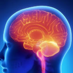 Terapie experimentală pentru bolnavii care au suferit accident vascular cerebral