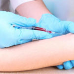 Centrul de Cercetare Johns Hopkins: test pentru depistarea precoce a cancerului