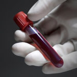 Testul de sânge care poate identifica opt tipuri de cancer