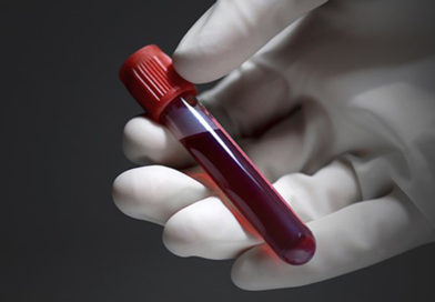 Testul de sânge care poate identifica opt tipuri de cancer