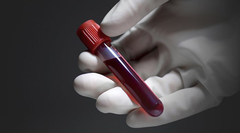 Testul de sânge care poate identifica opt tipuri de cancer