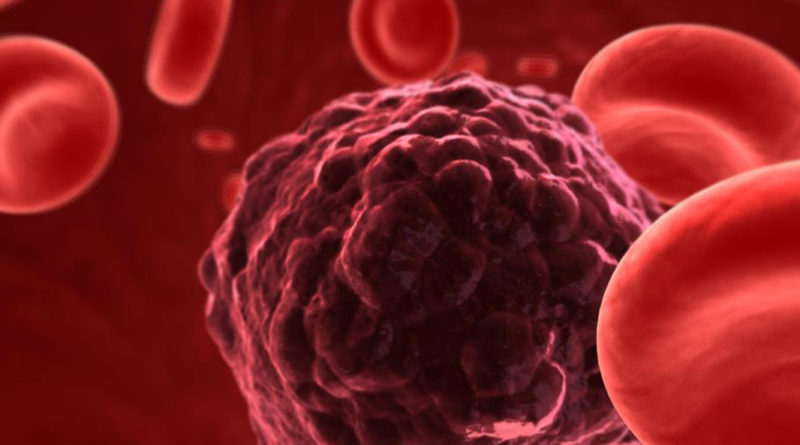 Cercetătorii au descoperit trăsături comune în cazul mai multor tipuri de cancer