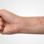 Cercetare: noi cauze pentru pielea uscata sau inflamata