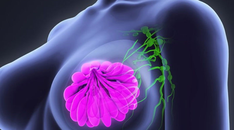 Medicament utilizat pentru tratarea osteoporozei, benefic în tratarea cancerului de sân