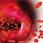 Legătura dintre bacteriile orale și cancerul pancreatic