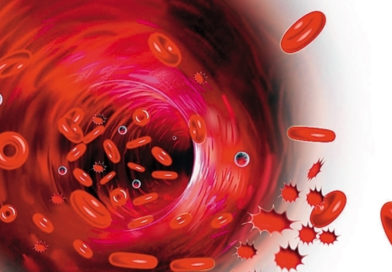 Legătura dintre bacteriile orale și cancerul pancreatic