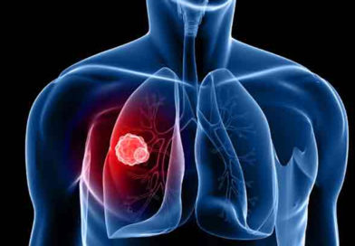 O nouă tehnică ar putea ajuta la tratarea fibrozei pulmonare