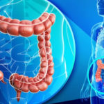 Care este legătura dintre obezitate și inflamația colonului?