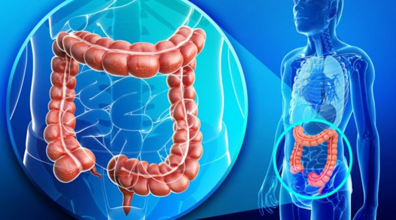 Care este legătura dintre obezitate și inflamația colonului?