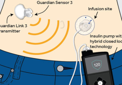 A fost inventat primul pancreas artificial din lume