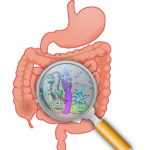 Cercetare: o nouă cauză pentru ulcerațiile la nivelul intestinului