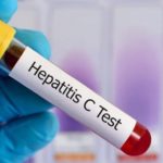A fost descoperit un medicament eficient în tratarea hepatitei C si a virusului HIV