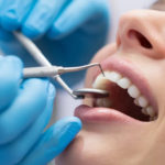 Noi speranțe pentru persoanele care se confruntă cu probleme dentare