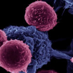Noile celule imune, ajutor în tratamentul împortiva cancerului