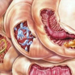 Cercetătorii continuă lupta împotriva paraziților intestinali