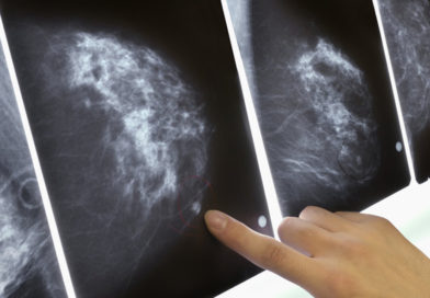Cancerul mamar, o noua descoperire