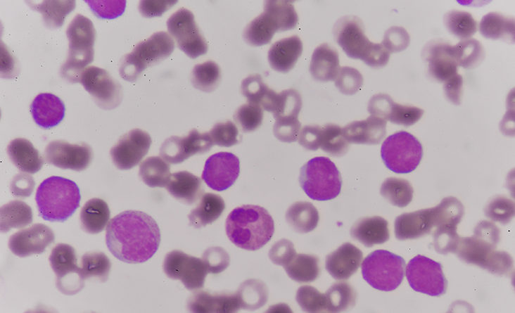 Enzima care poate genera apariția leucemiei