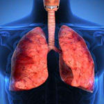 A fost descoperit un medicament revoluționar în tratarea tuberculozei