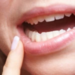 Legătura dintre infecțiile gingivale și cancerul de sân