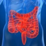 Iată ce trebuie să știi despre boala lui Hirschsprung!