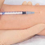 Testul de piele care poate detecta prezența unor agenți infecțioși
