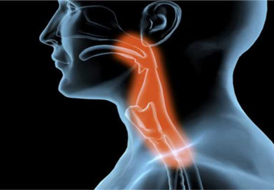 Metoda de detectare precoce a cancerului de esofag cu ajutorul unui burete