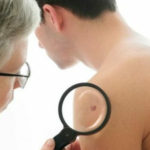 Studiu îngrijorător: din ce în ce mai mulți bărbați se îmbolnăvesc de cancer