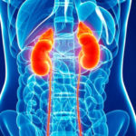 Noua metodă de detectare precoce a cancerului de rinichi