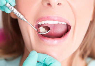 Medicamentul care poate fi folosit în tratarea cariilor dentare