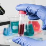 Cercetătorii belgieni au descoperit bacterii în sângele pesoanelor cu HIV, cancer și alte afecțiuni