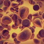 Ibrutinib, medicamentul minune în tratarea leucemiei la perosanele în vârstă