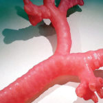 Cercetătorii sunt pe cale să realizele un transplant de trahee umană, imprimată 3D