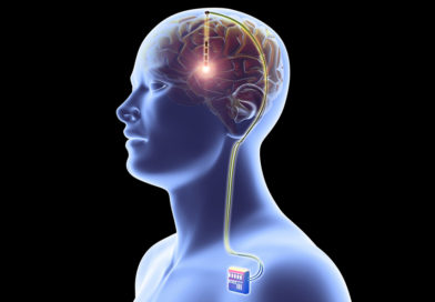 WAND, dispozitivul creat pentru persoanele cu afecțiuni neurologice