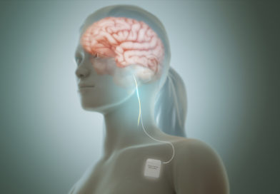Stimularea nervului vag, o metodă eficientă de tratament pentru persoanele care suferă de o afecțiune psihică gravă