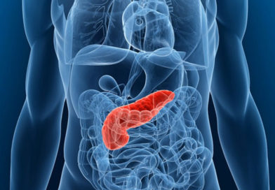 O nouă metodă de diagnosticare a cancerului pancreatic