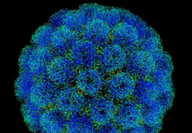 A fost descoperită o nouă metodă de detectare a cancerului