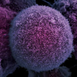 Oamenii de știință au descoperit celula de origine a cancerului