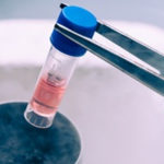Transplantul de celule stem, metodă revoluționară în tratarea sclerozei multiple