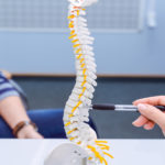 Mielofibroza este stimulată de semnalizarea excesivă a vitaminei D și a celulelor imune