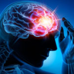 Iată ce trebuie să știi dacă suferi de epilepsie!
