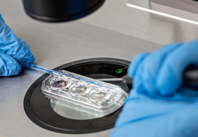 Femeile cu probleme de fertilitate au un risc crescut de a dezvolta cancer ovarian sau endometrial