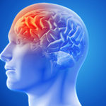 Noi constatări cu privire la obiectivele chirurgicale în hemoragia intracerebrală