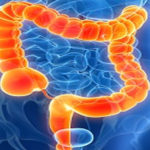 Agregarea particulelor din intestin poate influența absorbția de medicamente și substanțe nutritive