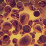 O nouă metodă care împiedică dezvoltarea leucemiei